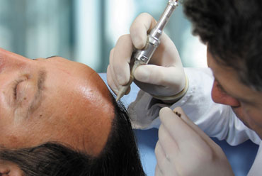 Hair Transplant Instruments